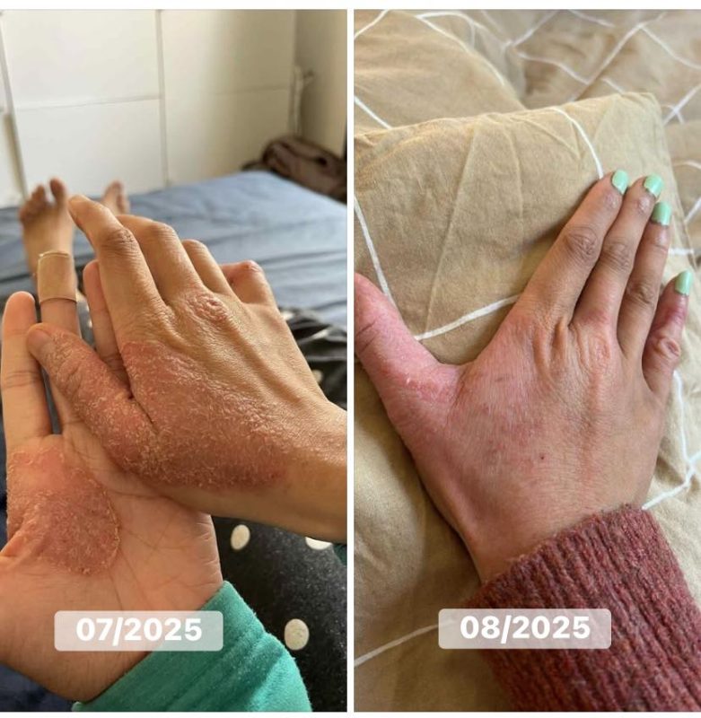 reiki giảm stress và lo âu